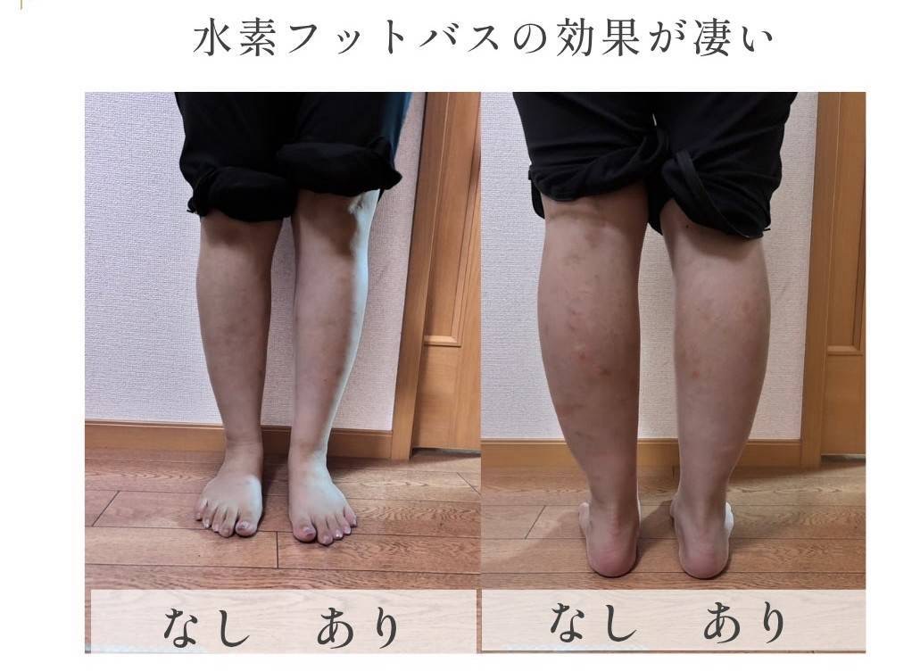 今すぐお問い合わせを！